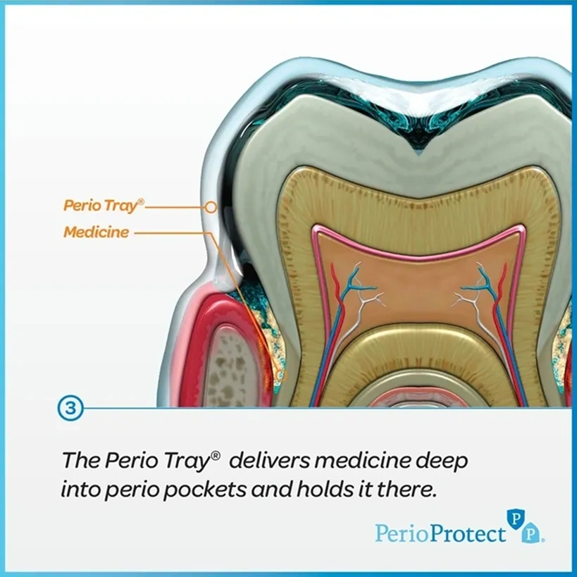 prio-protect-work-image